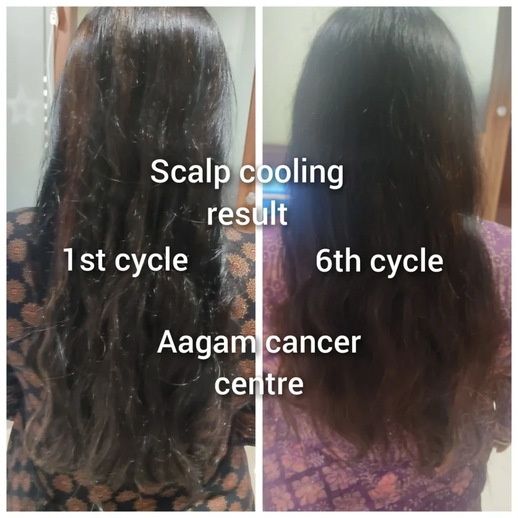 Scalp Cooling Facility1