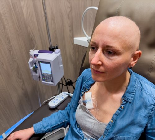 Chemotherapy in Cancer Treatment